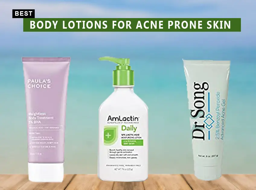 Best Body Lotions for Acne Prone Skin