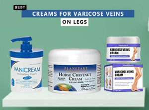Best Creams For Varicose Veins On Legs