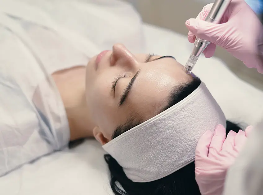How To Remove Dead Skin After Microneedling