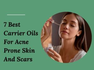 7 Best Carrier Oils For Acne Prone Skin And Scars