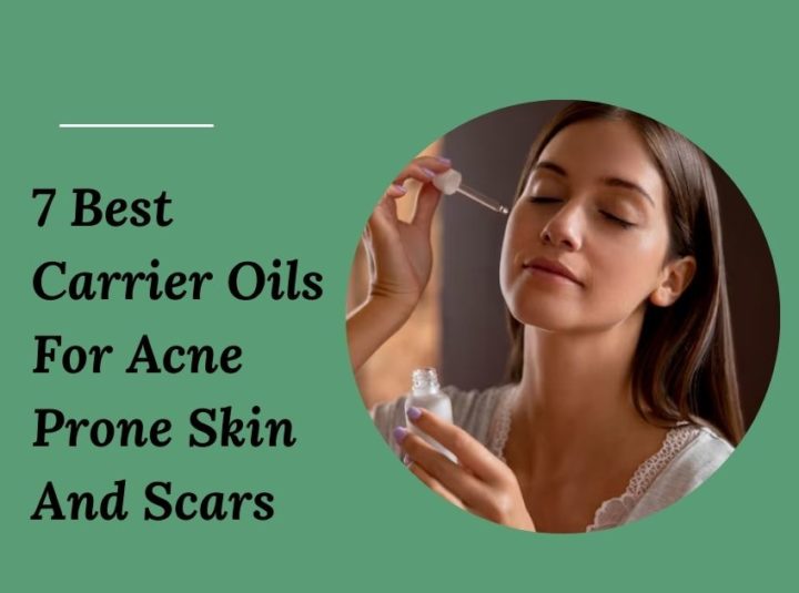 7 Best Carrier Oils For Acne Prone Skin And Scars In 2023